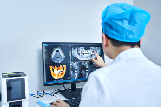 Best Emergency Tooth Extraction in Shasta, CA