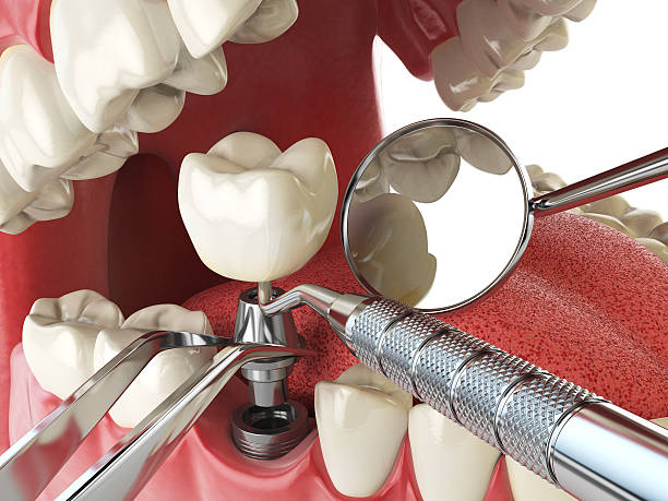 Best Emergency TMJ Treatment in Shasta, CA